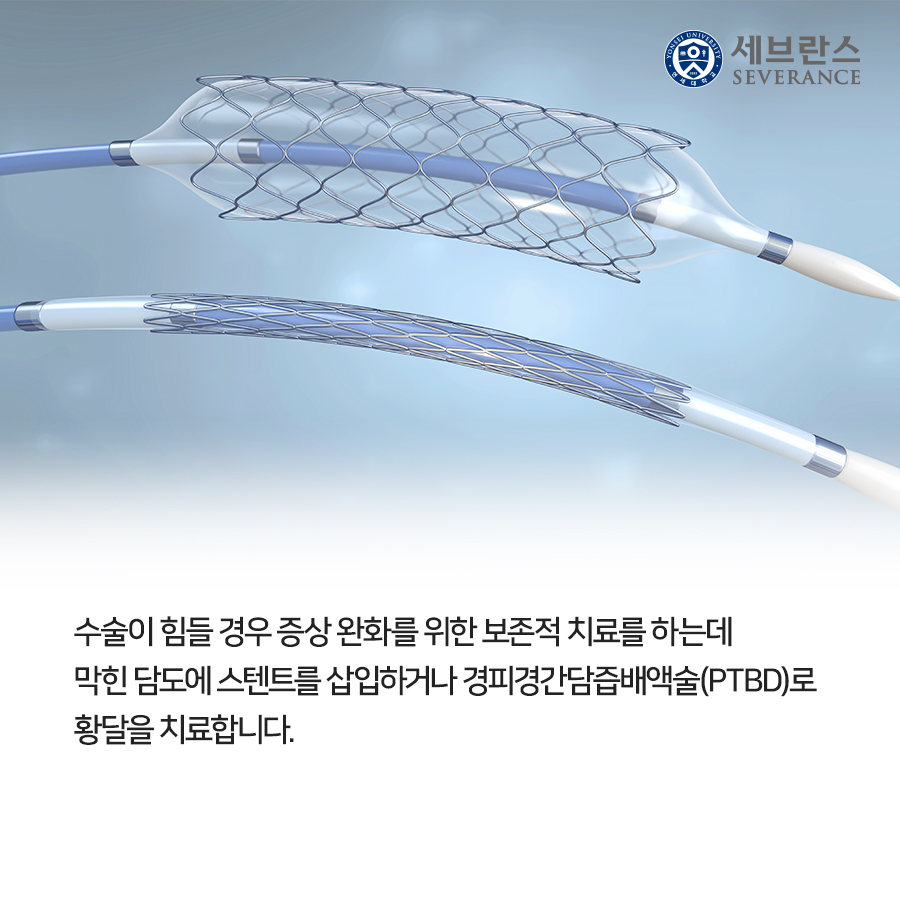 수술이 힘들 경우 증상 완화를 위한 보존적 치료를 하는데  막힌 담도에 스텐트를 삽입하거나 경피경간담즙배액술(PTBD)로  황달을 치료합니다.