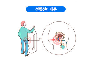 전립선비대증